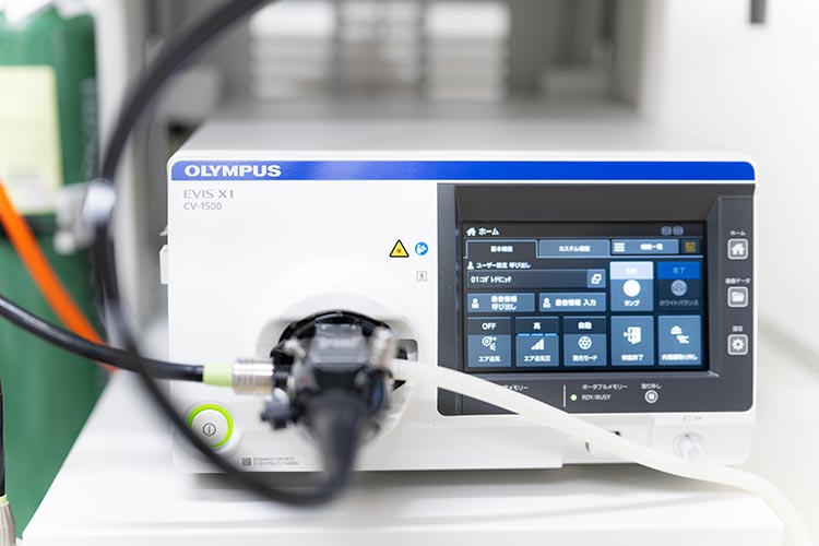 大腸内視鏡（大腸カメラ）とは